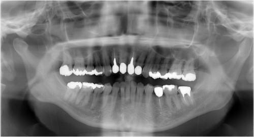松本１　初診時　◎